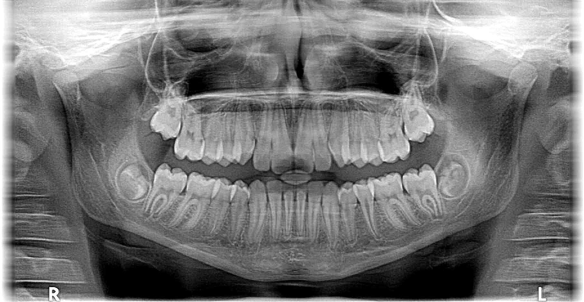 Radiologia